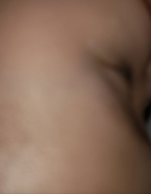 Bintik putih seperti panu