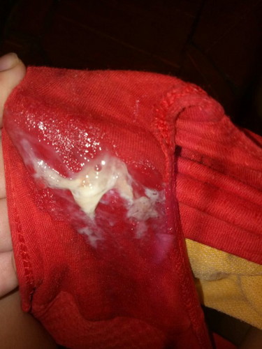 Pasintabi po normal lng po yan discharge na yan 38 weeks na po ako at open cervix na 1cm