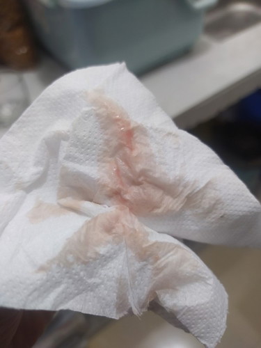 Implantation bleeding