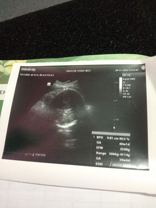 40week Hpl 28november