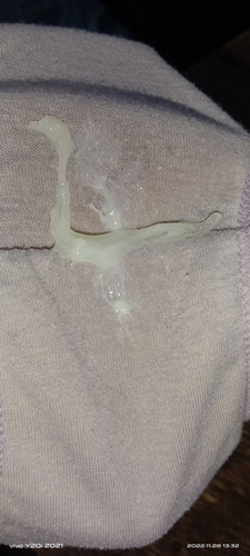 Mucus plug napo b to mga mi pasagot naman po ..38 weeks kona po ngaun ..lagi na rin sumasakit puson