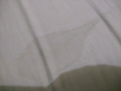 Rembesan ketuban apa keputihan