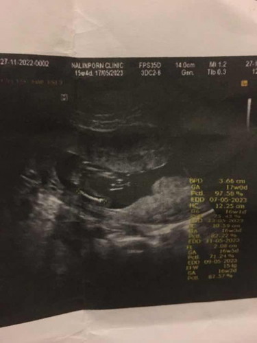 แม้ๆช่วยดูหน่อยค่ะ