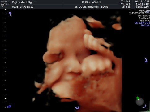 Masih nunggu gelombang cinta