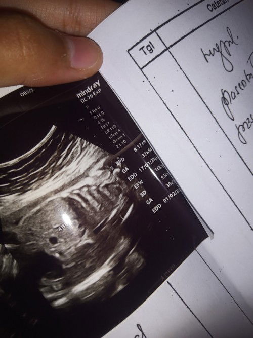 Mau tanya nih kak soal usia kehamilan