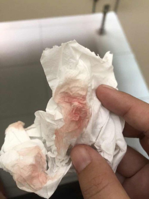 ตรวจภายในแล้วมีมูกเลือดไหลออกมา ถือว่าปกติไหมคะ แล้วไหลมันเยอะไหม ไหลกี่วันหายคะ ??