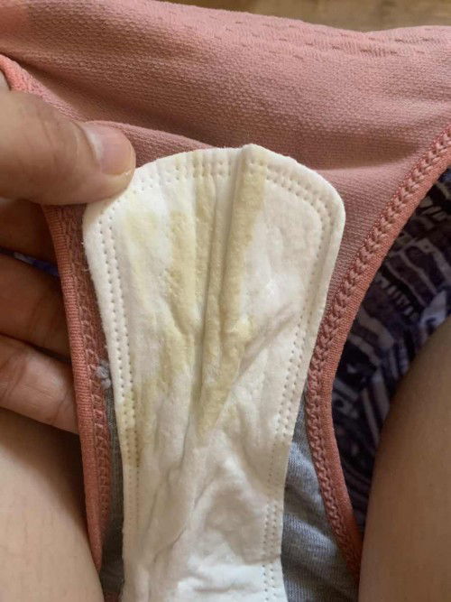 Brown and yellow discharge