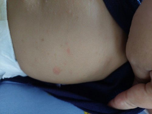 Skin problems kay baby