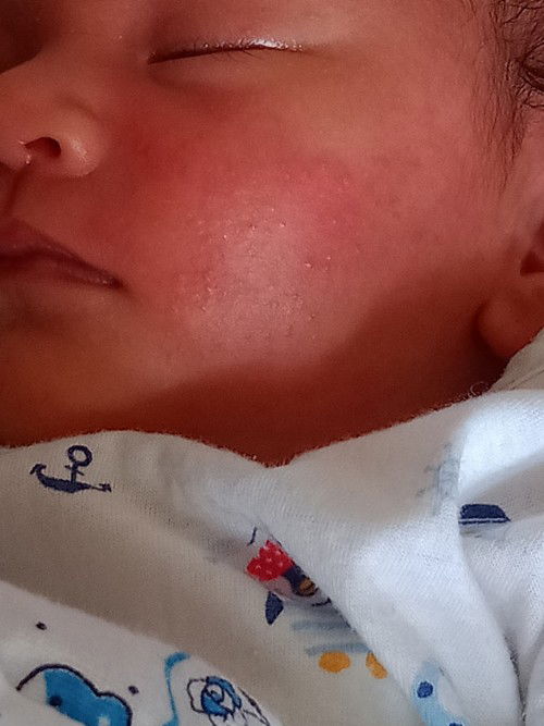 เป็นเเบบนี้เกิดจากอะไรค่ะ