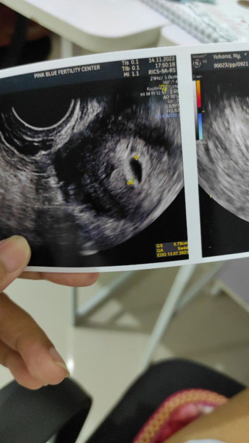 Bund mw tny dong ada ga yg usia 5w - 6w mual bgt , tp skrg otw 7w - 8w mual nya sangat berkurang?