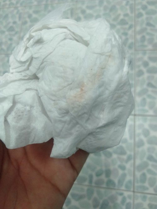 ท้องได้ประมาณเดือนหน่อยๆ เหมือนมีมูกเลือด