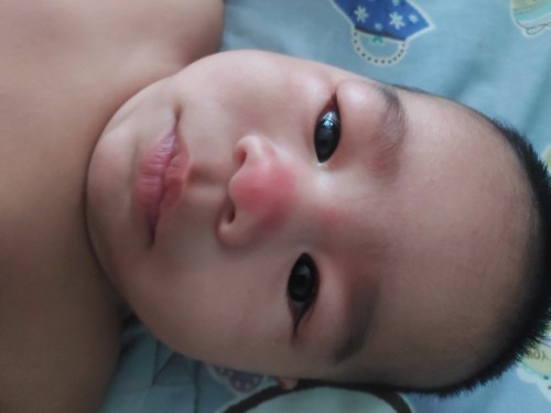 มีใครเคยเป็นบ้าง