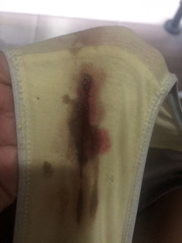 Excuse po sa kumakain (respect post po sana)