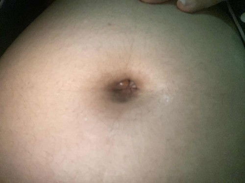 อายุครรภ์ 19 วีค มีปุ่มใส่ในสะดือ