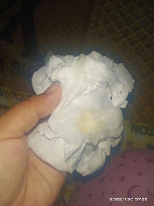 Keluar lendir dari jalan lahir