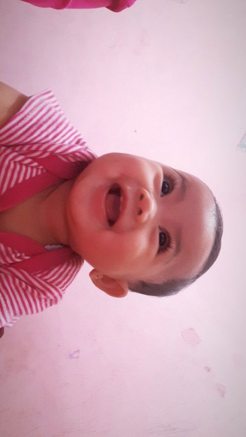 Bayi 7 bulan sudah ada 7 gigi yang tumbuh