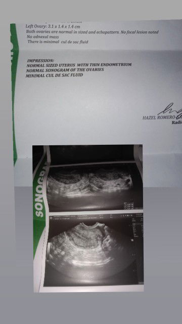 6 weeks and 4 days but....