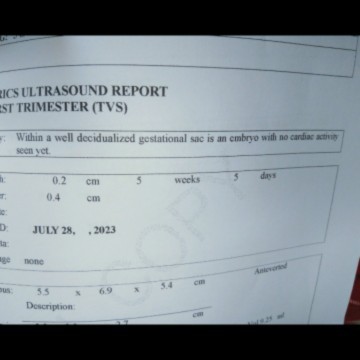 Possible po ba na hindi pa makita ang hb ni baby? 5weeks and 5days plang po sya ngpa check up po ako
