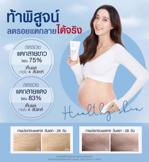 ถ้าท้องต้องอีฟส์ออยล์ ครีมทาท้องที่คุณแม่ต้องมี🥰