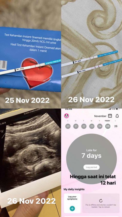 USG 2D hasil penebalan dinding rahim