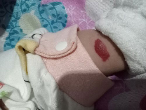 ปานแดงแต่เกิด