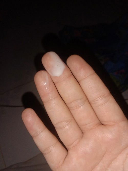 36+1
เป็นเเบบนี้คืออะไรค่ะ ไม่มีกลิ่น
ตื่นมาตี3ตกใจมากเป็นเยอะมาก