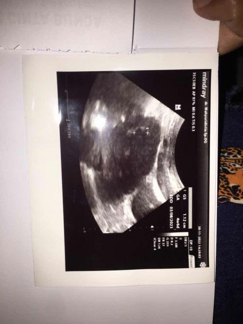 Bun Hasil Usg sama Hpht ko beda yaa?