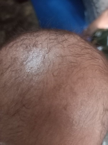 Penumbuh rambut bayi