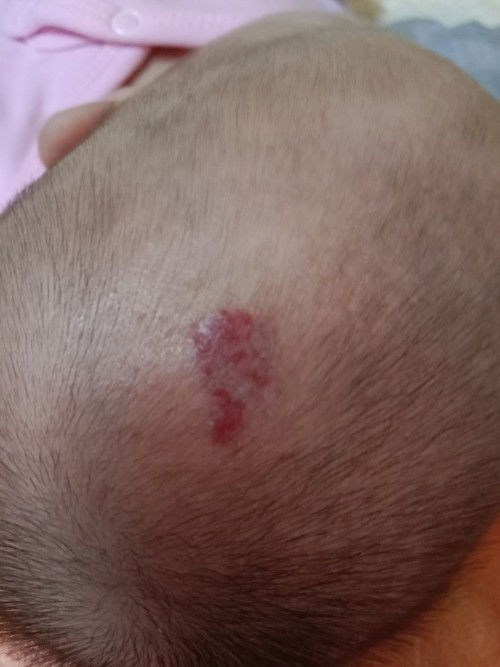 ปานสตอเบอร์รี่