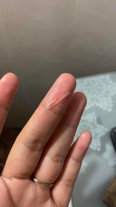 bercak dikit di usia 7 minggu