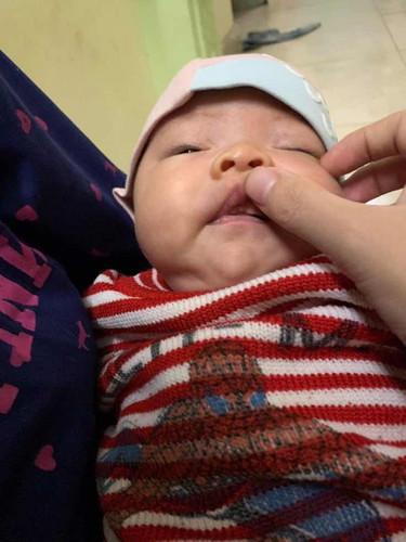 Các mẹ cho e hoi lợi cua bé nha e bị z thj co s k mn
