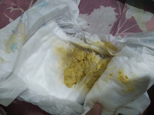 Baby poop 3 motnhs old