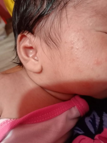 Ano po pweding ilunas po dto sa Mukha nang baby ku. Any cause noto po ?