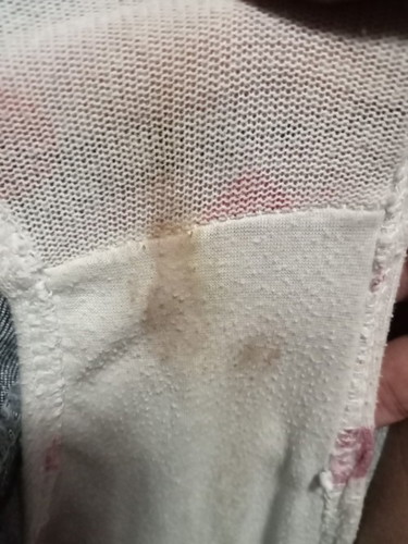 Magtatanong lang po kung spotting po ba yan? 1st time ko maexp. 11wk5dys po ako now.