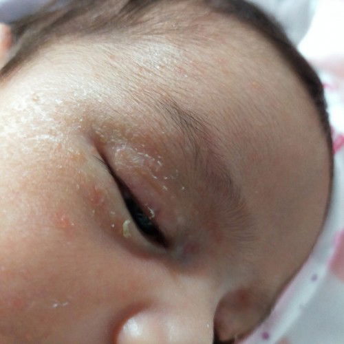 dry skin normal lang ba oh dahil sa soap na ginagamit nya