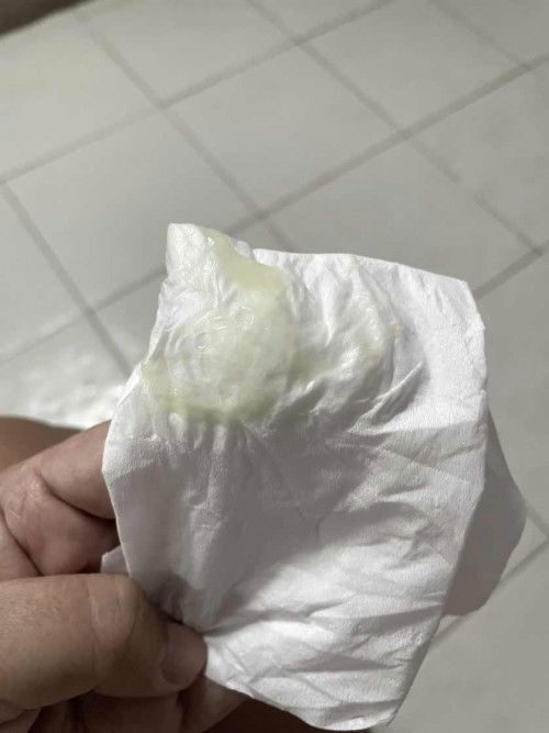 อายุครรภ์ 38 + 3