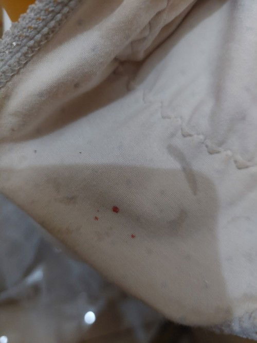 Bercak darah atau bukan?