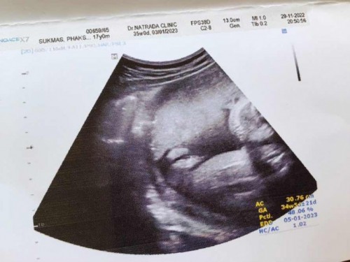 แม่ๆได้เพศอะไรกันบ้างคะ💕