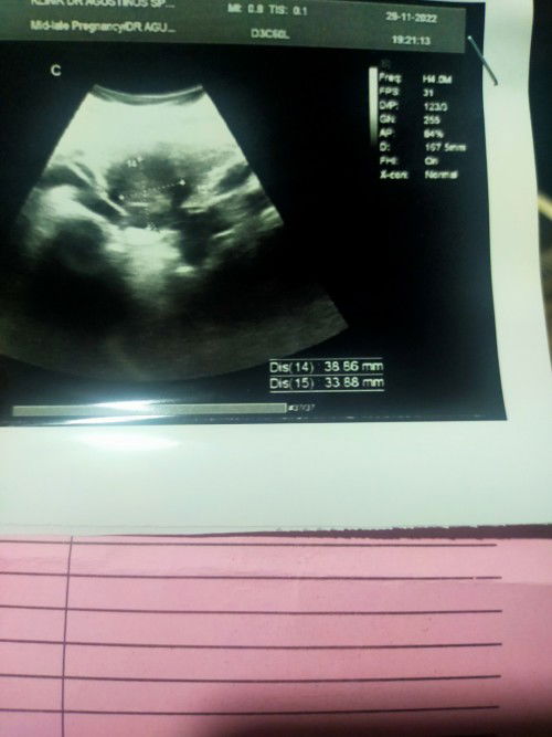 Untk postingan saya kemaren tespek garis dua