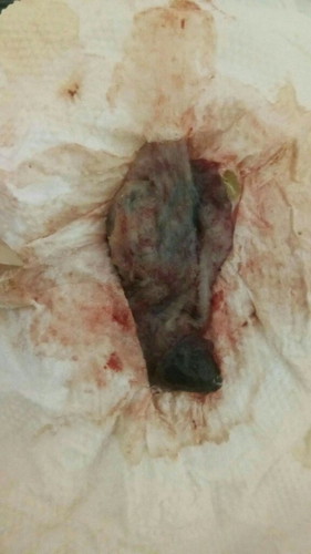 แบบนี้แท้งรึป่าวค่ะ