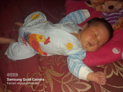 Pipi anak bintik merah ,apakah karena ruam susu? Cream yg bisa ngilangin ruam susu apa ya bun?