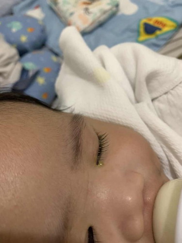 Nagmumuta mata ni baby