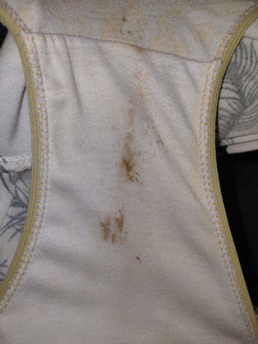 Brown discharge 6weeks pregnant