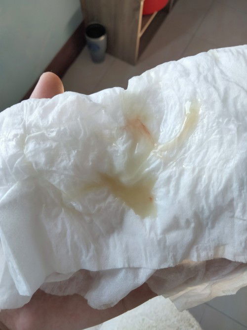 สอบถามแม่ๆค่ะท้องได้38W6D