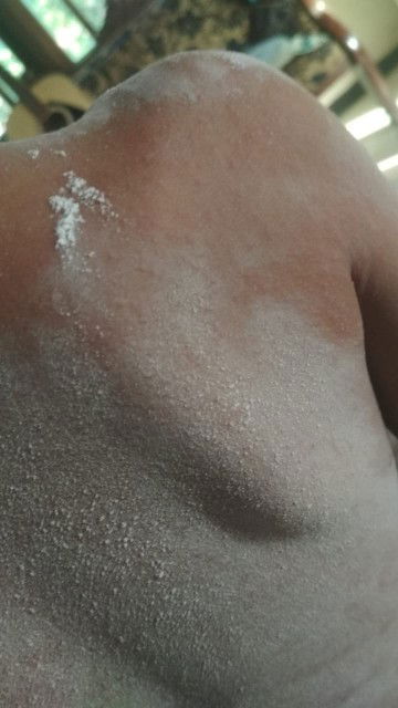 Badan anak panas dan keluar bintik² gatal sebadan