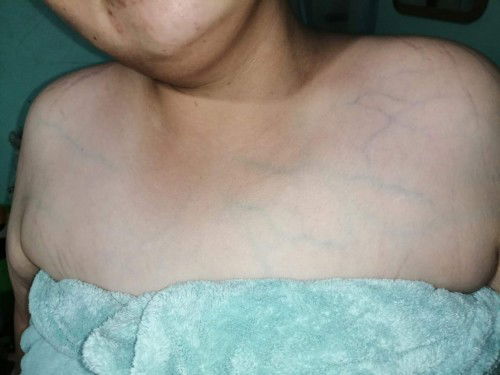 เกี่ยวกับการตั้งครรภ์หรือไม่