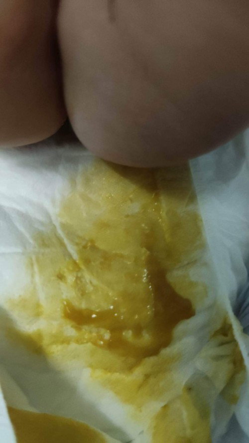 Poop ng 3 mos. Old baby