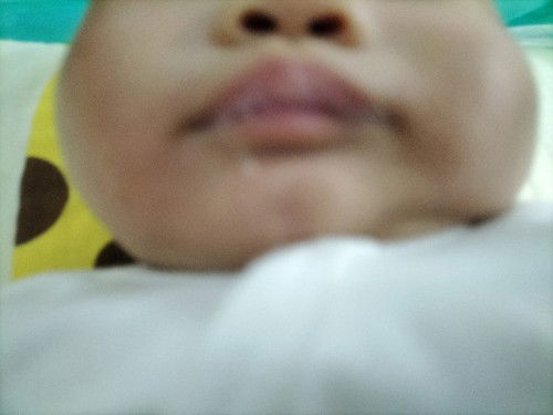 Chảy nước miếng ở trẻ 2 tháng tuổi