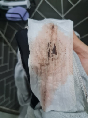 Normal ke bleeding macamni ye minggu ke 6?