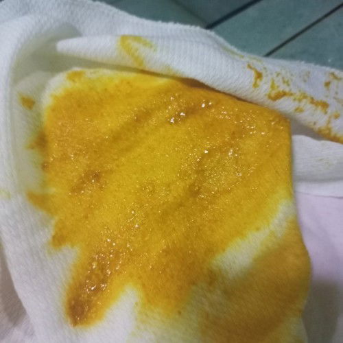 Diarhia po Ba kpg gnito??